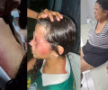 Mãe é detida por agredir filha de 12 anos em Miguel Alves