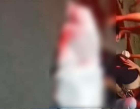 Jovem morre em colisão entre motocicleta e caminhão em Altos