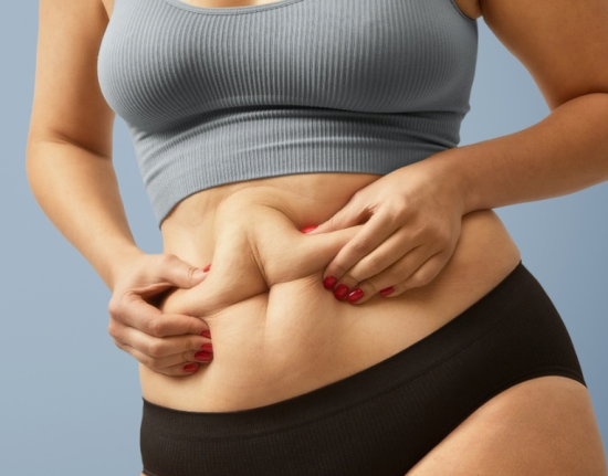 Excesso de pele após bariátrica: quando cirurgia vai além da estética