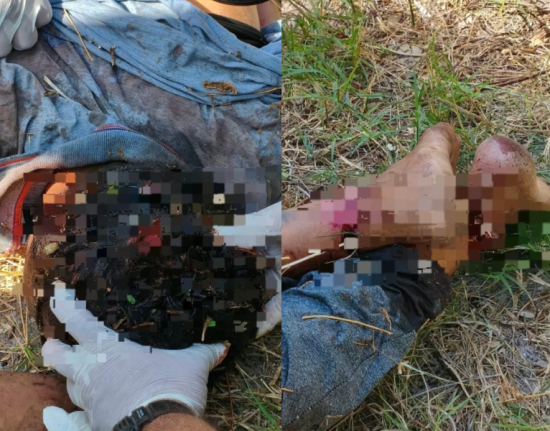 Mulher de 30 anos é encontrada morta com ferimentos de arma branca em Parnaíba