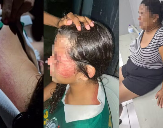 Mãe é detida por agredir filha de 12 anos em Miguel Alves