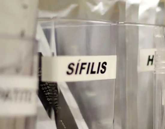 Sífilis continua em ritmo acelerado de crescimento no país