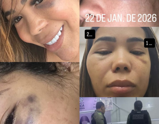 Influenciadora denuncia agressões do ex-namorado nas redes sociais