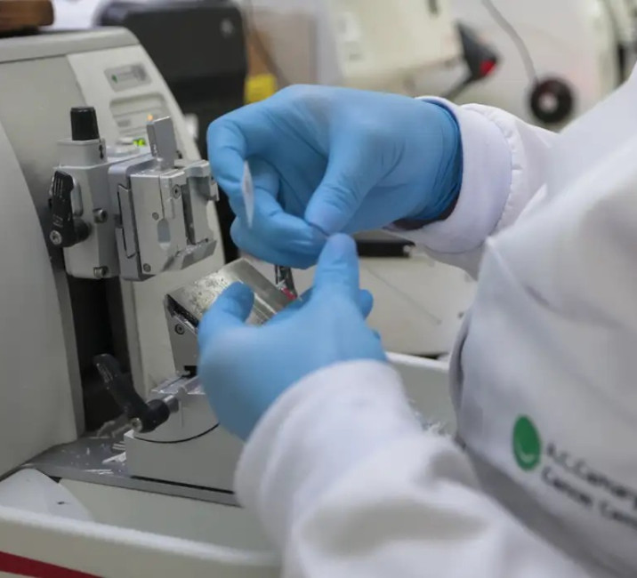 Câncer de próstata tem até 98% de chance de cura com diagnóstico precoce