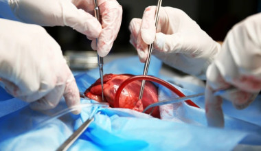 Mais de 570 piauienses aguardam transplante; córnea é o mais solicitado