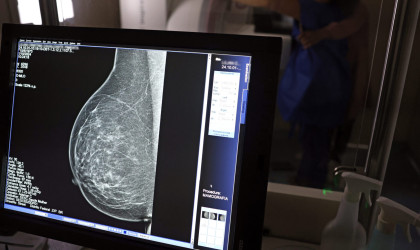 Piauí realiza 57 mil mamografias e recebe 224 medicamentos