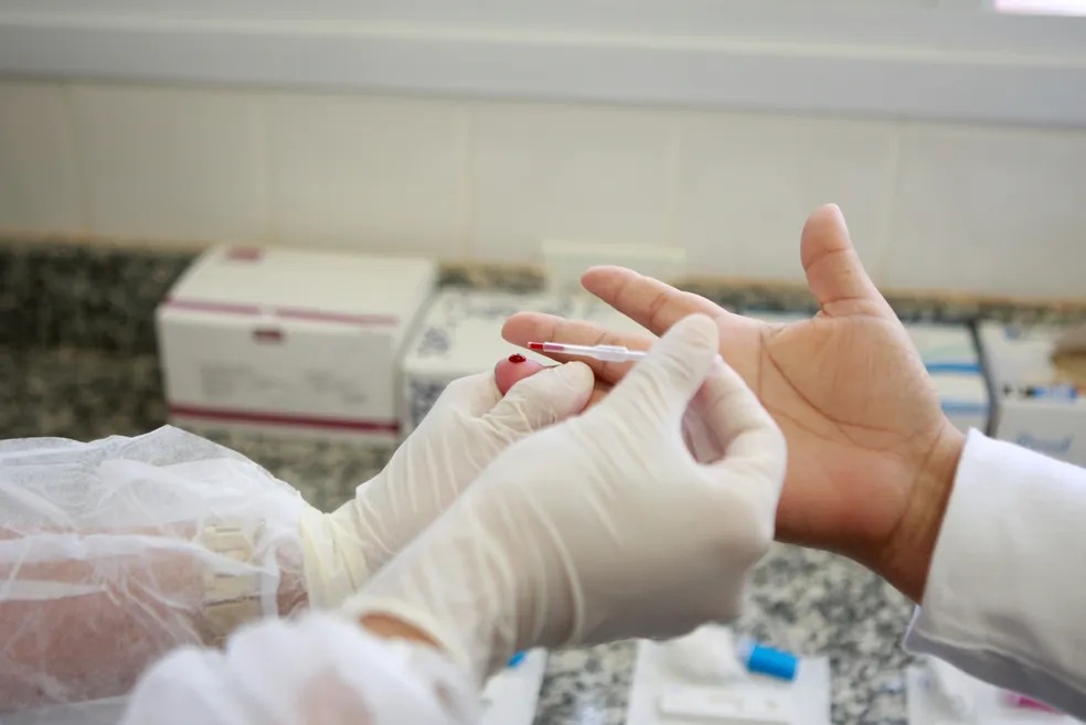 Ministério da Saúde realiza oficina sobre eliminação da Aids e do HIV