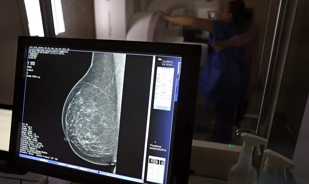 Mamografia agora é recomendada a partir dos 40 anos