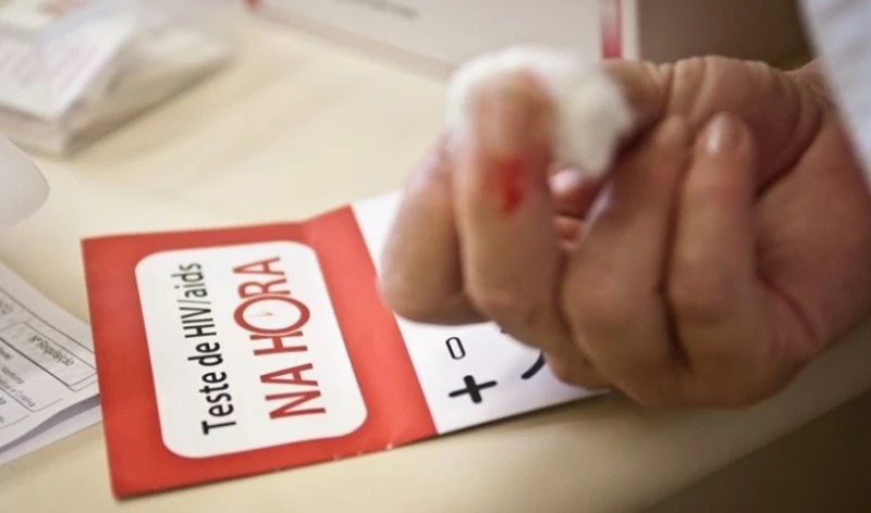 Piauí registra aumento de casos de HIV; jovens estão entre os mais atingidos