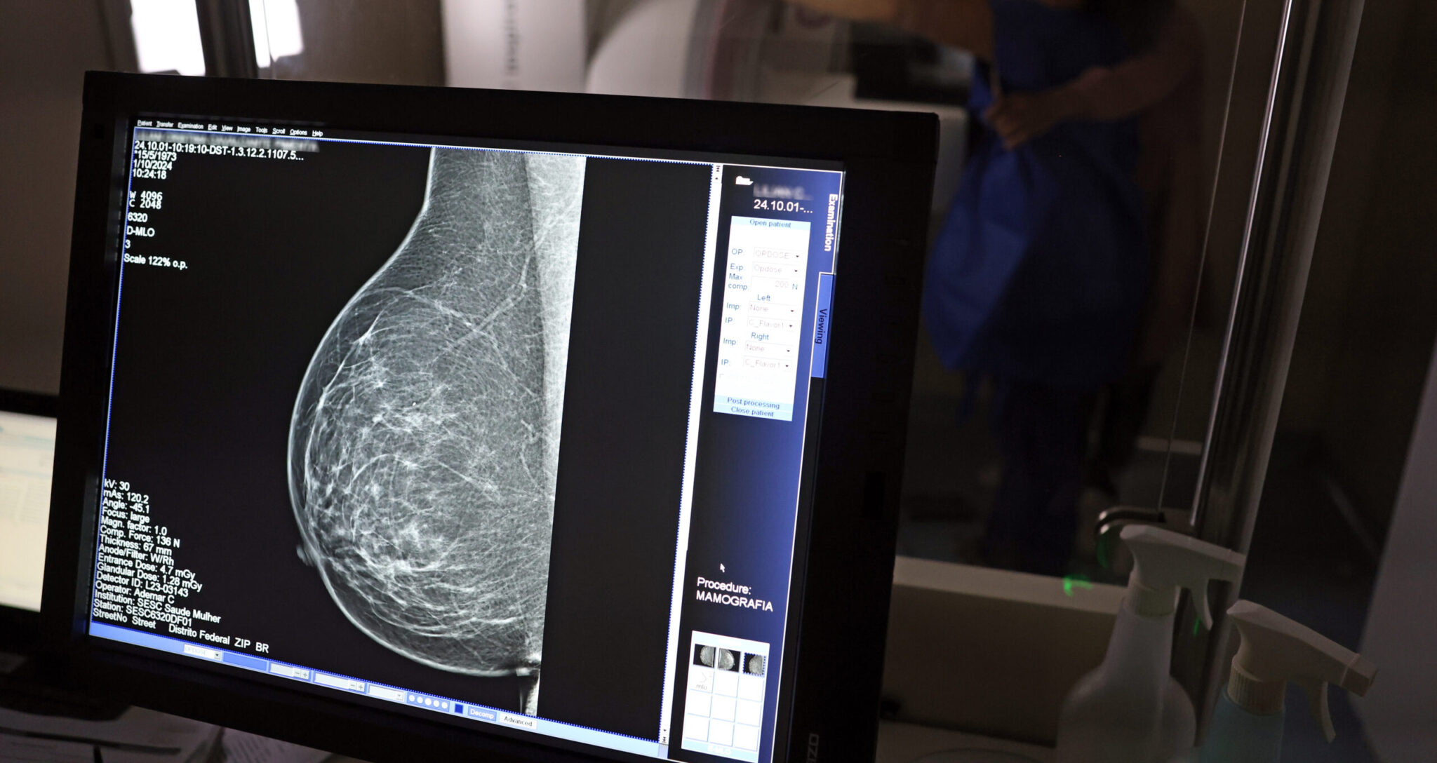 Piauí realiza 57 mil mamografias e recebe 224 medicamentos