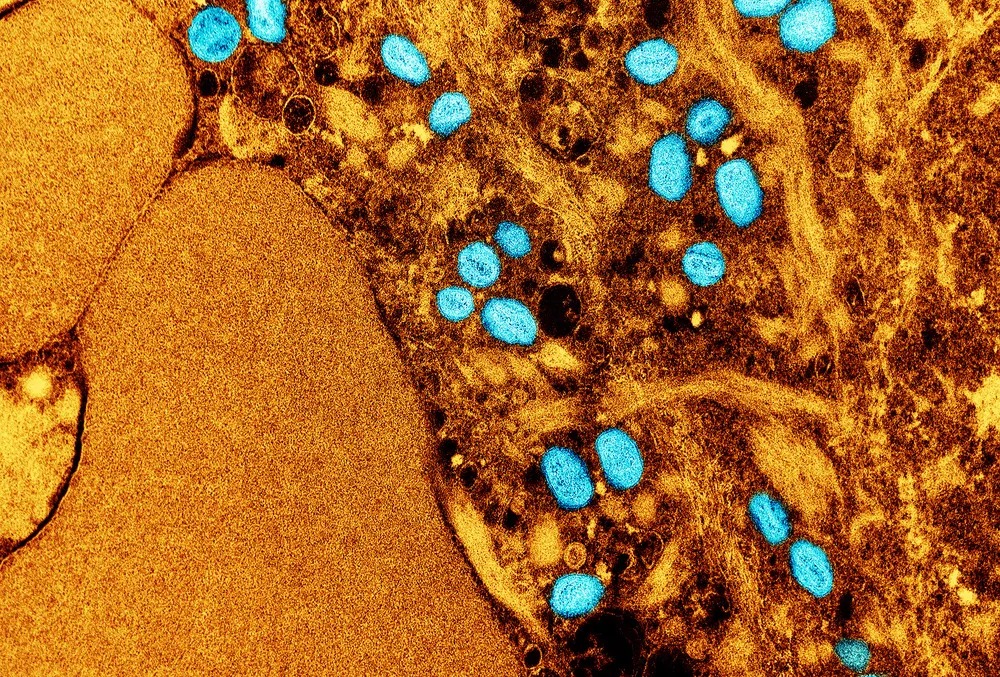 Mpox: entenda como o vírus é transmitido e os principais sintomas