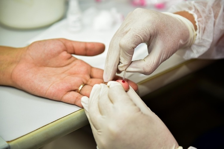Sesapi reforça importância da prevenção e tratamento das hepatites virais