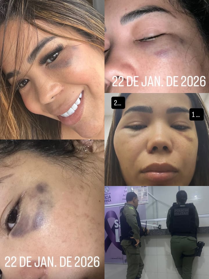 Influenciadora denuncia agressões do ex-namorado nas redes sociais